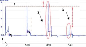 مقایسه ولتاژ پیک شمع‌ها در یک موتور چهارسیلندر
