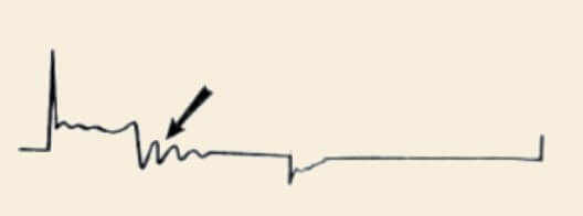 بررسی ناحیه میانی